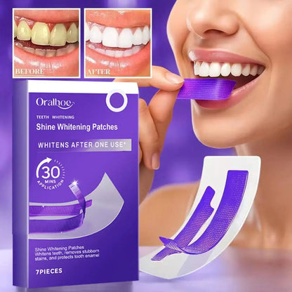 7 PCS Teeth Whitening Strips – Teeth Bleaching Stickers for Removing Yellow Stains