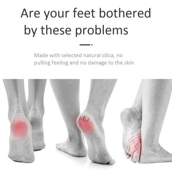 Get Rid of Calluses and Dead Skin with This Ultra-Fast Electric Foot File Vacuum