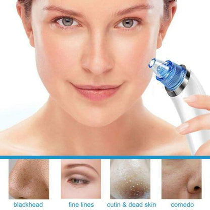 Remove blackheads and impurities without squeezing with DermaSuction