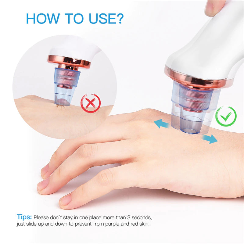 Remove blackheads and impurities without squeezing with DermaSuction